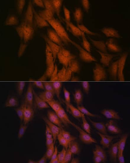 Immunocytochemistry/ Immunofluorescence: GLI-3 Antibody (8B1E2) [NBP3-16166] - Immunofluorescence analysis of C6 cells using GLI-3 Rabbit mAb  at dilution of 1:100 (40x lens). Blue: DAPI for nuclear staining.