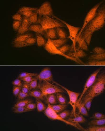 Immunocytochemistry/ Immunofluorescence: GLI-3 Antibody (8B1E2) [NBP3-16166] - Immunofluorescence analysis of U-2 OS cells using GLI-3 Rabbit mAb  at dilution of 1:100 (40x lens). Blue: DAPI for nuclear staining.