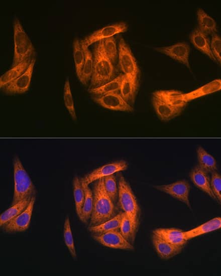 Immunocytochemistry/ Immunofluorescence: TAB1 Antibody (2W0P2) [NBP3-16167] - Immunofluorescence analysis of U-2 OS cells using TAB1 Rabbit mAb  at dilution of 1:100 (40x lens). Blue: DAPI for nuclear staining.