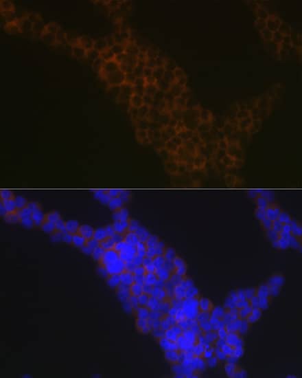 Immunocytochemistry/ Immunofluorescence: LSP1 Antibody (4U10N5) [NBP3-16171] - Immunofluorescence analysis of Jurkat cells using LSP1 Rabbit mAb  at dilution of 1:100 (40x lens). Blue: DAPI for nuclear staining.