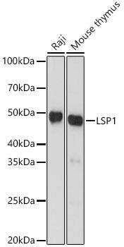 Western Blot: LSP1 Antibody (4U10N5) [NBP3-16171] - Western blot analysis of various lysates, using LSP1 Rabbit mAb  at 1:1000 dilution.Secondary antibody: HRP Goat Anti-Rabbit IgG (H+L)  at 1:10000 dilution.Lysates/proteins: 25ug per lane.Blocking buffer: 3% nonfat dry milk in TBST.Detection: ECL Basic Kit .Exposure time: 60s.