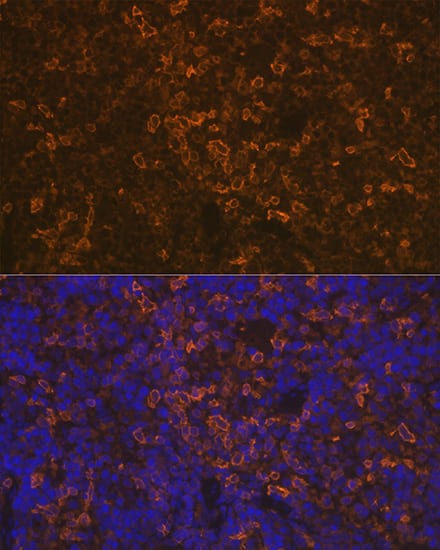 Immunocytochemistry/ Immunofluorescence: LSP1 Antibody (4U10N5) [NBP3-16171] - Immunofluorescence analysis of rat spleen using LSP1 Rabbit mAb  at dilution of 1:100 (40x lens). Blue: DAPI for nuclear staining.