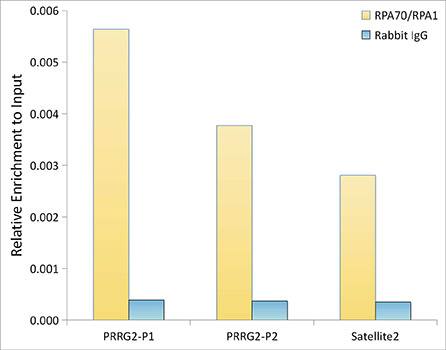 Chromatin Immunoprecipitation: RPA70 Antibody (5R7S3) [RPA70] - Chromatin immunoprecipitation analysis of extracts of HeLa cells, using RPA70 Rabbit mAb antibody  and rabbit IgG.The amount of immunoprecipitated DNA was checked by quantitative PCR. Histogram was constructed by the ratios of the immunoprecipitated DNA to the input.