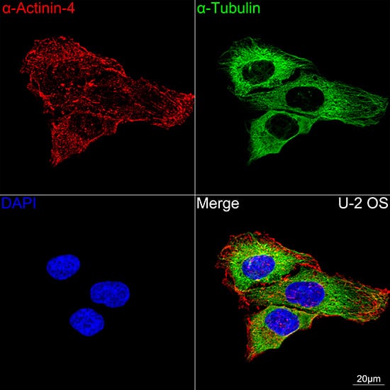 Immunocytochemistry/ Immunofluorescence: Alpha Actinin 4 Antibody (5Y3R6) [NBP3-16176] - Confocal imaging of U-2 OS cells using Alpha Actinin 4 Rabbit mAb  followed by a further incubation with Cy3 Goat Anti-Rabbit IgG (H+L)  . The cells were counterstained with alpha-Tubulin Mouse mAb  followed by incubation with ABflo 488-conjugated Goat Anti-Mouse IgG (H+L) Ab  (Green). DAPI was used for nuclear staining (Blue). Objective: 100x.