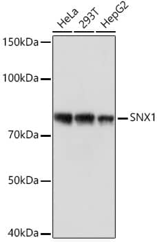 Western Blot: SNX1 Antibody (8G8Z2) [NBP3-16181] - Western blot analysis of extracts of various cell lines, using SNX1 Rabbit mAb  at 1:1000 dilution.Secondary antibody: HRP Goat Anti-Rabbit IgG (H+L)  at 1:10000 dilution.Lysates/proteins: 25ug per lane.Blocking buffer: 3% nonfat dry milk in TBST.Detection: ECL Basic Kit .Exposure time: 1s.