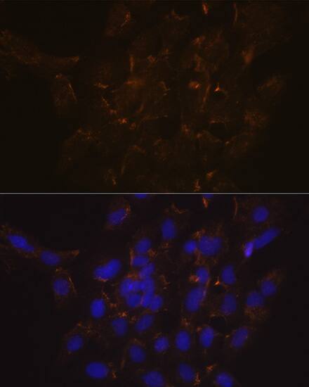 Immunocytochemistry/ Immunofluorescence: Phospholipid Scramblase 1/PLSCR1 Antibody (5U6G1) [NBP3-16183] - Immunofluorescence analysis of C6 cells using Phospholipid Phospholipid Scramblase 1/PLSCR1 (PLSCR1) Rabbit mAb at dilution of 1:100 (40x lens). Secondary antibody: Cy3 Goat Anti-Rabbit IgG (H+L) at 1:500 dilution. Blue: DAPI for nuclear staining.