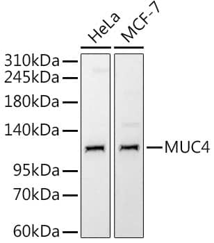 Western Blot: MUC4 Antibody (5J3R7) [NBP3-16186] - Western blot analysis of various lysates using MUC4 Rabbit mAb at 1:1000 dilution.Secondary antibody: HRP Goat Anti-Rabbit IgG (H+L) at 1:10000 dilution.Lysates/proteins: 25ug per lane.Blocking buffer: 3% nonfat dry milk in TBST.Detection: ECL Enhanced Kit.Exposure time: 10s.