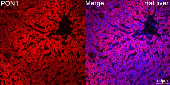 Immunocytochemistry/ Immunofluorescence: PON1 Antibody (4X7X2) [NBP3-16187] - Confocal imaging of paraffin-embedded Rat liver tissue using PON1 Rabbit mAb  followed by a further incubation with Cy3 Goat Anti-Rabbit IgG (H+L) . DAPI was used for nuclear staining (Blue). Objective: 40x. Perform high pressure antigen retrieval with 0.01 M citrate buffer (pH 6.0) prior to IF staining.