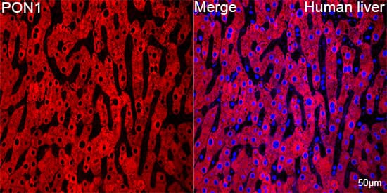 Immunocytochemistry/ Immunofluorescence: PON1 Antibody (4X7X2) [NBP3-16187] - Confocal imaging of paraffin-embedded Human liver tissue using PON1 Rabbit mAb followed by a further incubation with Cy3 Goat Anti-Rabbit IgG (H+L) . DAPI was used for nuclear staining (Blue). Objective: 40x. Perform high pressure antigen retrieval with 0.01 M citrate buffer (pH 6.0) prior to IF staining.