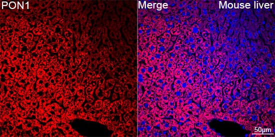Immunocytochemistry/ Immunofluorescence: PON1 Antibody (4X7X2) [NBP3-16187] - Confocal imaging of paraffin-embedded Mouse liver tissue using PON1 Rabbit mAb followed by a further incubation with Cy3 Goat Anti-Rabbit IgG (H+L) . DAPI was used for nuclear staining (Blue). Objective: 40x. Perform high pressure antigen retrieval with 0.01 M citrate buffer (pH 6.0) prior to IF staining.