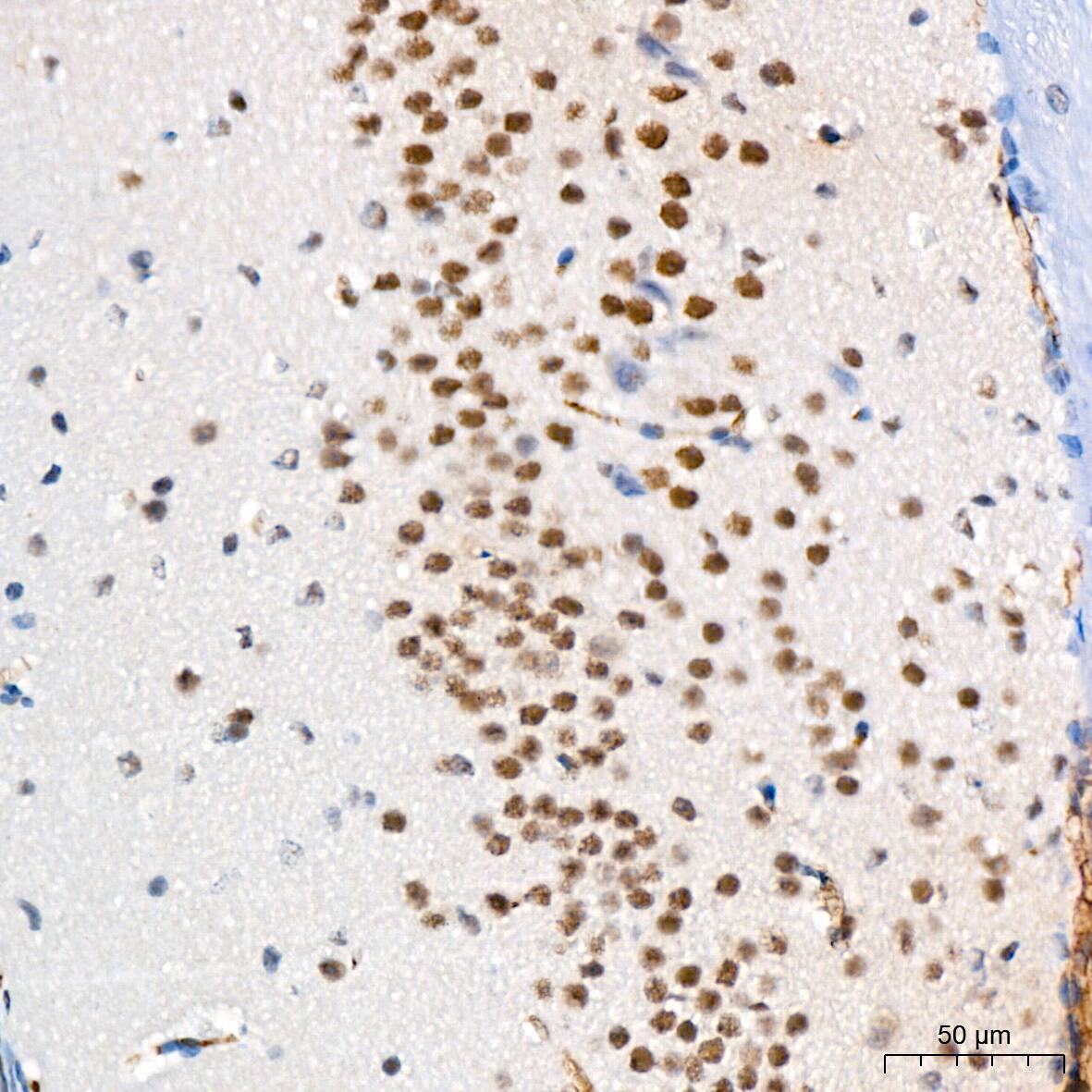 Immunohistochemistry: USP7 Antibody (3J7G1) [NBP3-16188] - Immunohistochemistry analysis of paraffin-embedded Mouse brain tissue using USP7 Rabbit mAb at a dilution of 1:200 (40x lens). High pressure antigen retrieval performed with 0.01M Citrate Bufferr (pH 6.0) prior to IHC staining.