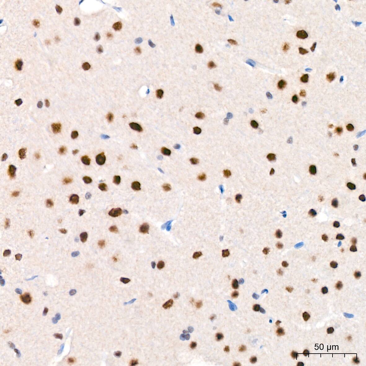 Immunohistochemistry: USP7 Antibody (3J7G1) [NBP3-16188] - Immunohistochemistry analysis of paraffin-embedded Rat brain tissue using USP7 Rabbit mAb at a dilution of 1:200 (40x lens). High pressure antigen retrieval performed with 0.01M Citrate Bufferr (pH 6.0) prior to IHC staining.