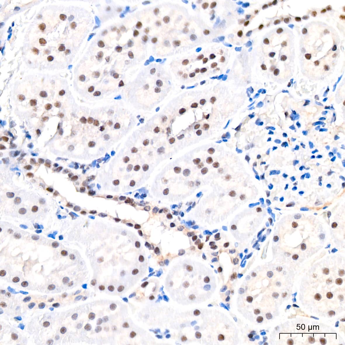 Immunohistochemistry: USP7 Antibody (3J7G1) [NBP3-16188] - Immunohistochemistry analysis of paraffin-embedded Rat kidney tissue using USP7 Rabbit mAb at a dilution of 1:200 (40x lens). High pressure antigen retrieval performed with 0.01M Citrate Bufferr (pH 6.0) prior to IHC staining.