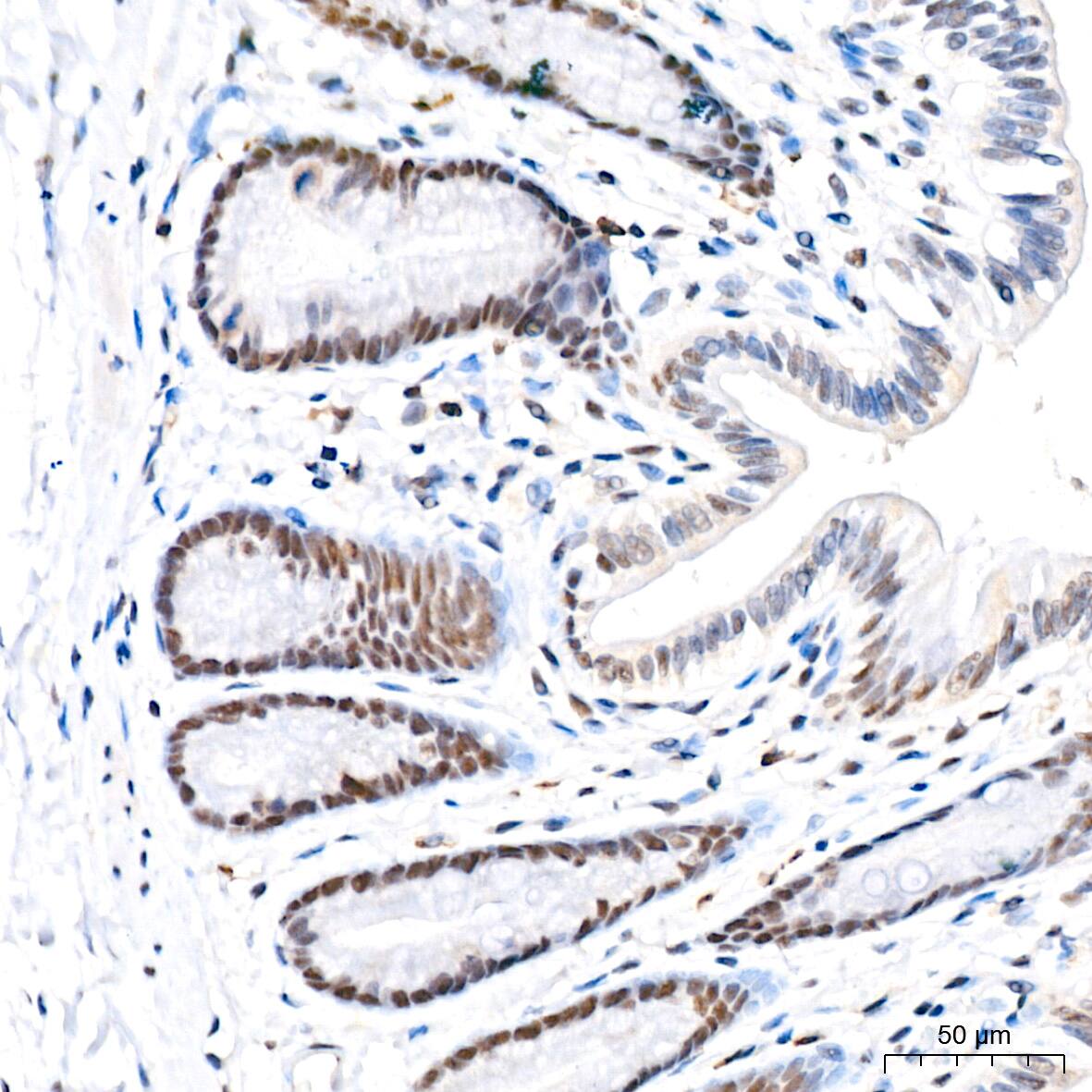 Immunohistochemistry: USP7 Antibody (3J7G1) [NBP3-16188] - Immunohistochemistry analysis of paraffin-embedded Rat colon tissue using USP7 Rabbit mAb at a dilution of 1:200 (40x lens). High pressure antigen retrieval performed with 0.01M Citrate Bufferr (pH 6.0) prior to IHC staining.