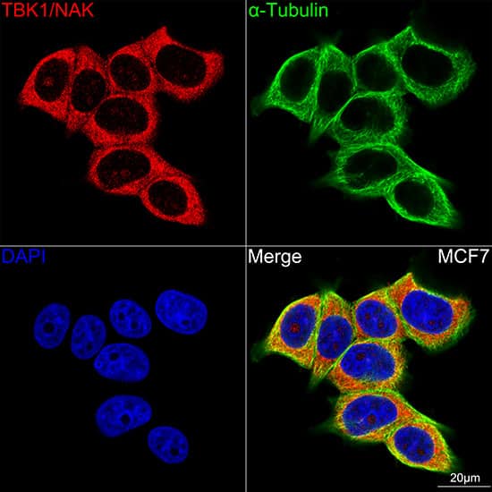 Immunocytochemistry/ Immunofluorescence: TBK1 Antibody (4G6C7) [NBP3-16189] - Confocal imaging of MCF7 cells using TBK1 Rabbit mAb . The cells were counterstained with alpha-Tubulin Mouse mAb (Green). DAPI was used for nuclear staining (blue). Objective: 100x.