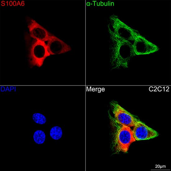 Immunocytochemistry/ Immunofluorescence: S100A6 Antibody (0J1Q5) [NBP3-16191] - Confocal imaging of C2C12 cells using S100A6 Rabbit mAb followed by a further incubation with Cy3 Goat Anti-Rabbit IgG (H+L) . The cells were counterstained with alpha-Tubulin Mouse mAb followed by incubation with ABflo(R) 488-conjugated Goat Anti-Mouse IgG (H+L) Ab (Green). DAPI was used for nuclear staining (Blue). Objective: 100x.