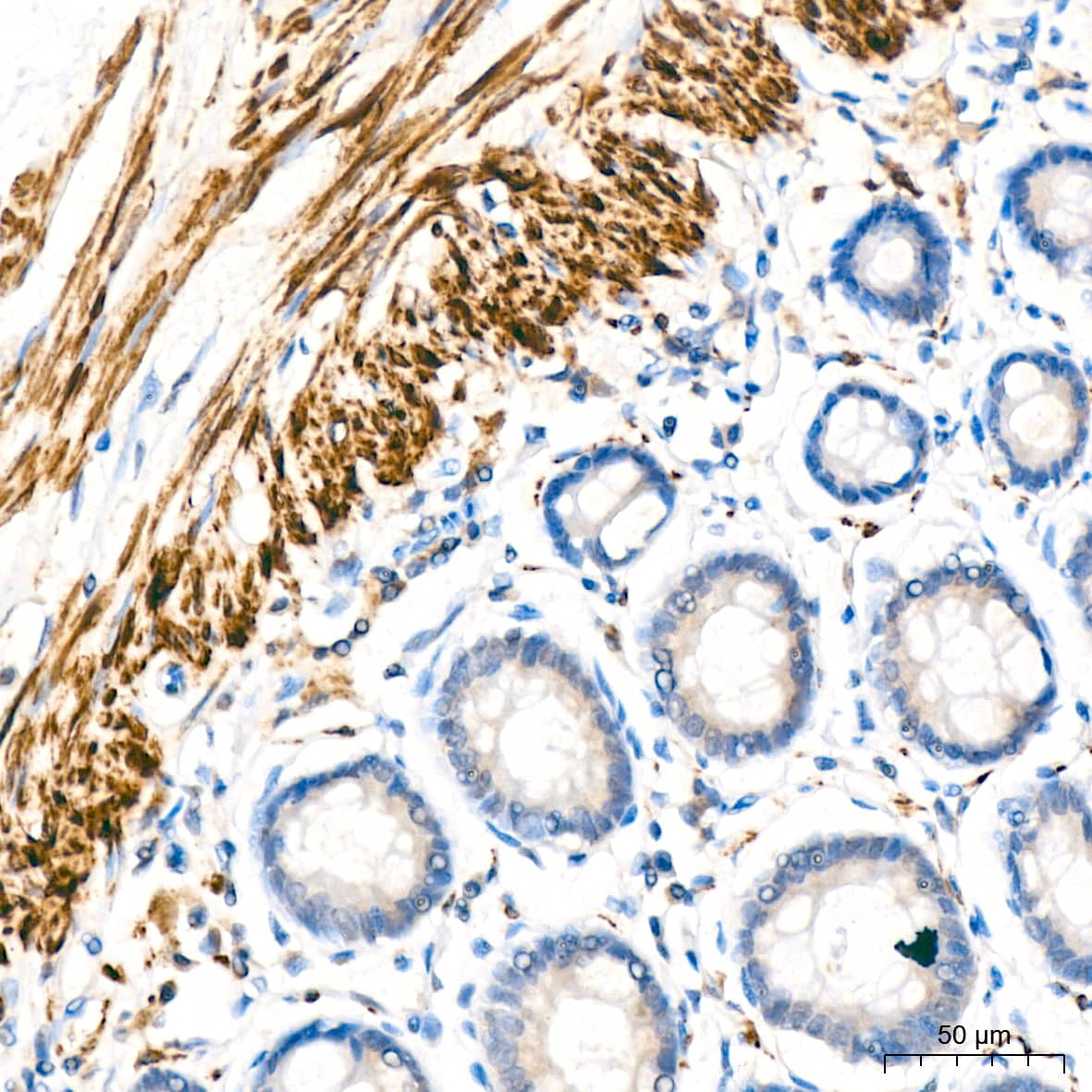 Immunohistochemistry: IKK epsilon/IKBKE Antibody (5N4J8) [NBP3-16192] - Immunohistochemistry analysis of paraffin-embedded human colon tissue using IKK epsilon/IKBKE Rabbit mAb at a dilution of 1:200 (40x lens).High pressure antigen retrieval was performed with 0.01 M citrate buffer (pH 6.0) prior to IHC staining.