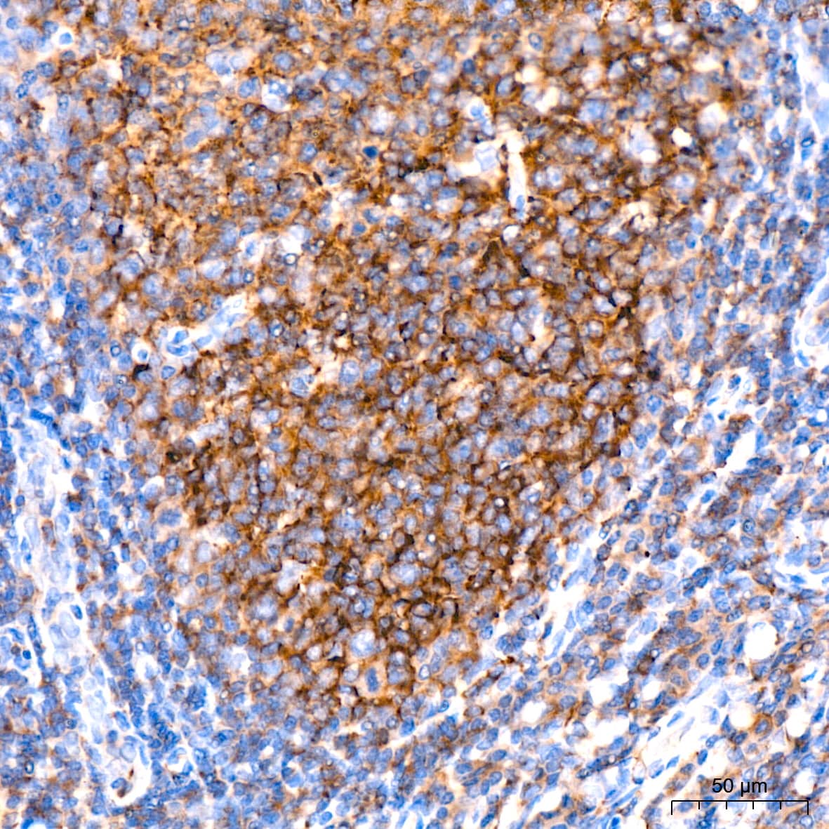 Immunohistochemistry: IKK epsilon/IKBKE Antibody (5N4J8) [NBP3-16192] - Immunohistochemistry analysis of paraffin-embedded human tonsil tissue using IKK epsilon/IKBKE Rabbit mAb at a dilution of 1:200 (40x lens).High pressure antigen retrieval was performed with 0.01 M citrate buffer (pH 6.0) prior to IHC staining.