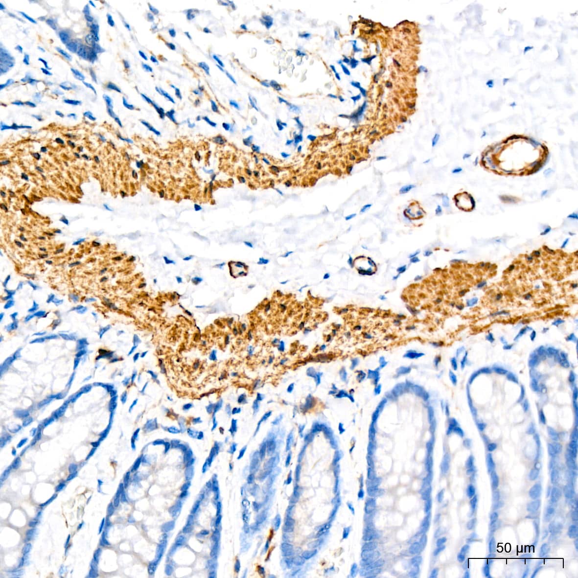 Immunohistochemistry: IKK epsilon/IKBKE Antibody (5N4J8) [NBP3-16192] - Immunohistochemistry analysis of paraffin-embedded rat colon tissue using IKK epsilon/IKBKE Rabbit mAb at a dilution of 1:200 (40x lens).High pressure antigen retrieval was performed with 0.01 M citrate buffer (pH 6.0) prior to IHC staining.