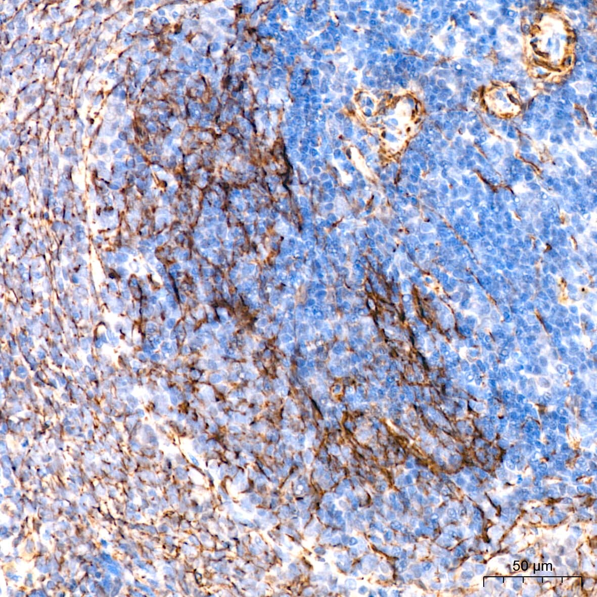 Immunohistochemistry: IKK epsilon/IKBKE Antibody (5N4J8) [NBP3-16192] - Immunohistochemistry analysis of paraffin-embedded rat spleen tissue using IKK epsilon/IKBKE Rabbit mAb at a dilution of 1:200 (40x lens).High pressure antigen retrieval was performed with 0.01 M citrate buffer (pH 6.0) prior to IHC staining.