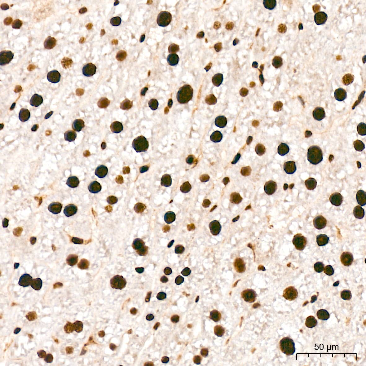 Immunohistochemistry: ANP32B Antibody (4A8E5) [NBP3-16199] - Immunohistochemistry analysis of ANP32B in paraffin-embedded rat liver tissue using ANP32B Rabbit mAb  at a dilution of 1:200 (40x lens). High pressure antigen retrieval was performed with 0.01 M citrate buffer (pH 6.0) prior to IHC staining.