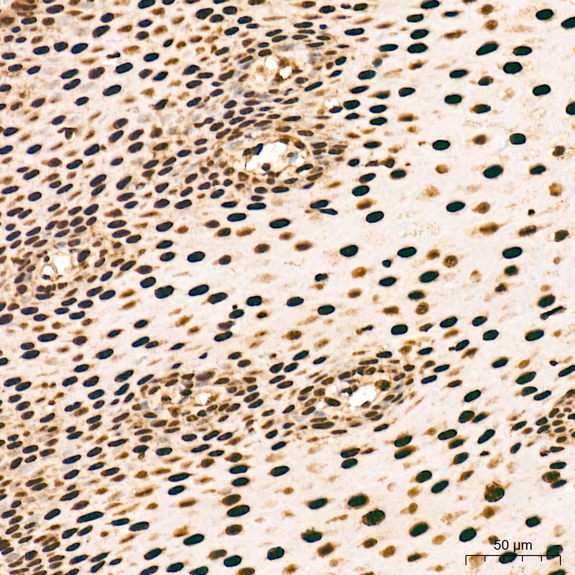 Immunohistochemistry: ANP32B Antibody (4A8E5) [NBP3-16199] - Immunohistochemistry analysis of ANP32B in paraffin-embedded human esophagus tissue using ANP32B Rabbit mAb  at a dilution of 1:200 (40x lens). High pressure antigen retrieval was performed with 0.01 M citrate buffer (pH 6.0) prior to IHC staining.