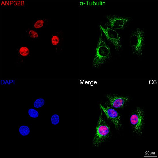 Immunocytochemistry/ Immunofluorescence: ANP32B Antibody (4A8E5) [NBP3-16199] - Confocal imaging of C6 cells using ANP32B Rabbit mAb  followed by a further incubation with Cy3 Goat Anti-Rabbit IgG (H+L)  . The cells were counterstained with alpha-Tubulin Mouse mAb  followed by incubation with ABflo 488-conjugated Goat Anti-Mouse IgG (H+L) Ab  (Green). DAPI was used for nuclear staining (Blue). Objective: 100x.