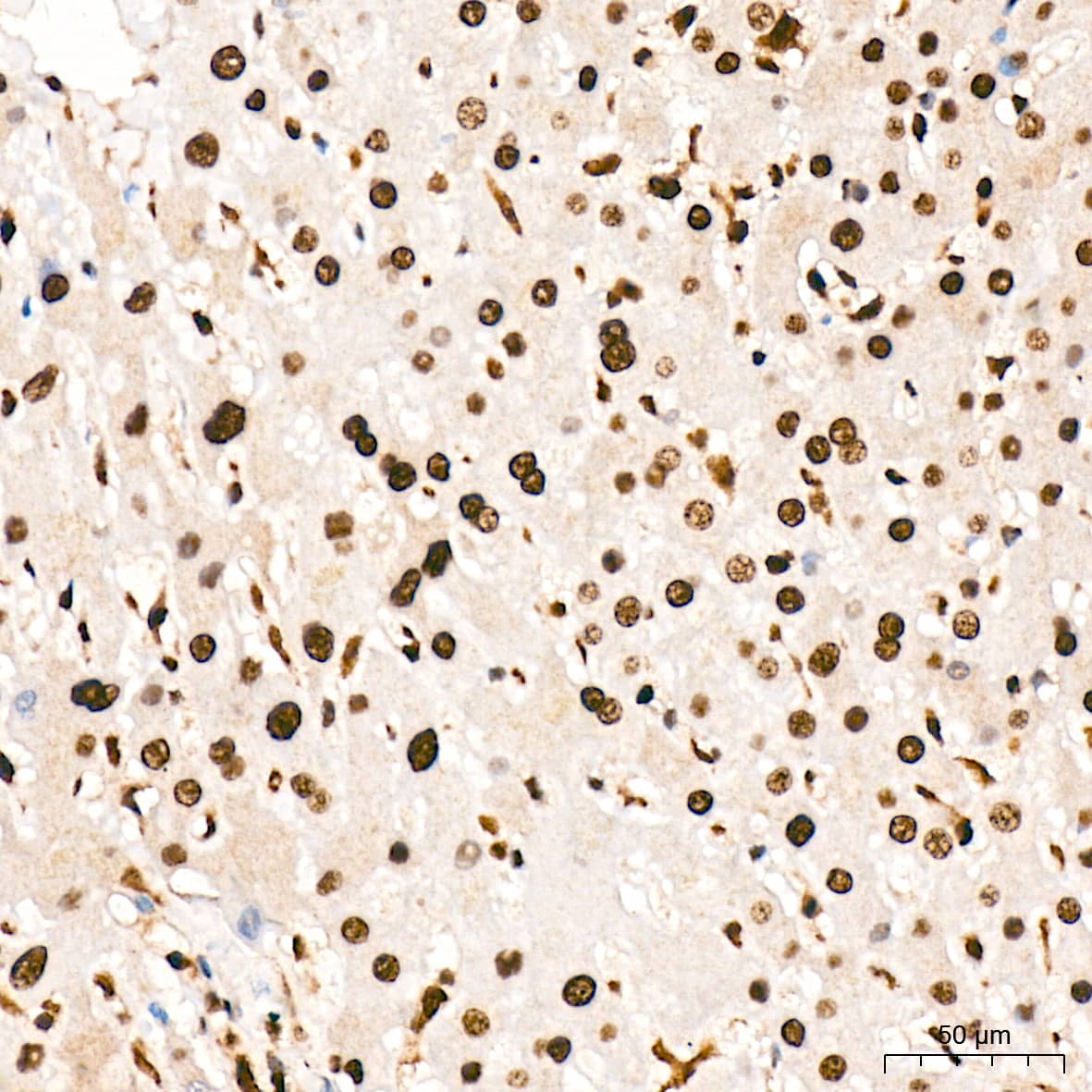 Immunohistochemistry: ANP32B Antibody (4A8E5) [NBP3-16199] - Immunohistochemistry analysis of ANP32B in paraffin-embedded human liver tissue using ANP32B Rabbit mAb  at a dilution of 1:200 (40x lens). High pressure antigen retrieval was performed with 0.01 M citrate buffer (pH 6.0) prior to IHC staining.