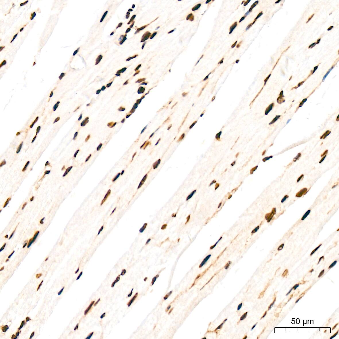 Immunohistochemistry: ANP32B Antibody (4A8E5) [NBP3-16199] - Immunohistochemistry analysis of ANP32B in paraffin-embedded mouse heart tissue using ANP32B Rabbit mAb  at a dilution of 1:200 (40x lens). High pressure antigen retrieval was performed with 0.01 M citrate buffer (pH 6.0) prior to IHC staining.