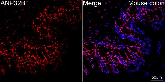 Immunocytochemistry/ Immunofluorescence: ANP32B Antibody (4A8E5) [NBP3-16199] - Confocal imaging of paraffin-embedded Mouse colon tissue using ANP32B Rabbit mAb  followed by a further incubation with Cy3 Goat Anti-Rabbit IgG (H+L)  . DAPI was used for nuclear staining (Blue). Objective: 40x. Perform high pressure antigen retrieval with 0.01 M citrate buffer (pH 6.0) prior to IF staining.