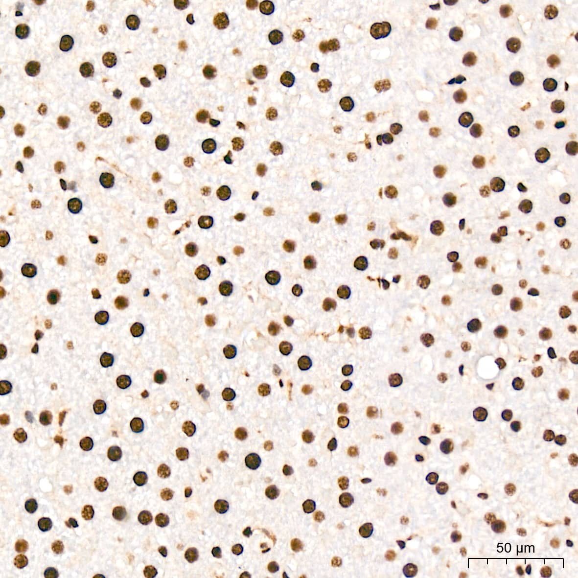 Immunohistochemistry: ANP32B Antibody (4A8E5) [NBP3-16199] - Immunohistochemistry analysis of ANP32B in paraffin-embedded mouse liver tissue using ANP32B Rabbit mAb  at a dilution of 1:200 (40x lens). High pressure antigen retrieval was performed with 0.01 M citrate buffer (pH 6.0) prior to IHC staining.