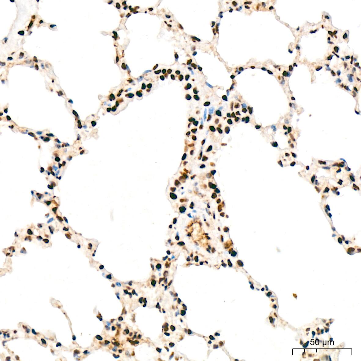 Immunohistochemistry: ANP32B Antibody (4A8E5) [NBP3-16199] - Immunohistochemistry analysis of ANP32B in paraffin-embedded rat lung tissue using ANP32B Rabbit mAb  at a dilution of 1:200 (40x lens). High pressure antigen retrieval was performed with 0.01 M citrate buffer (pH 6.0) prior to IHC staining.