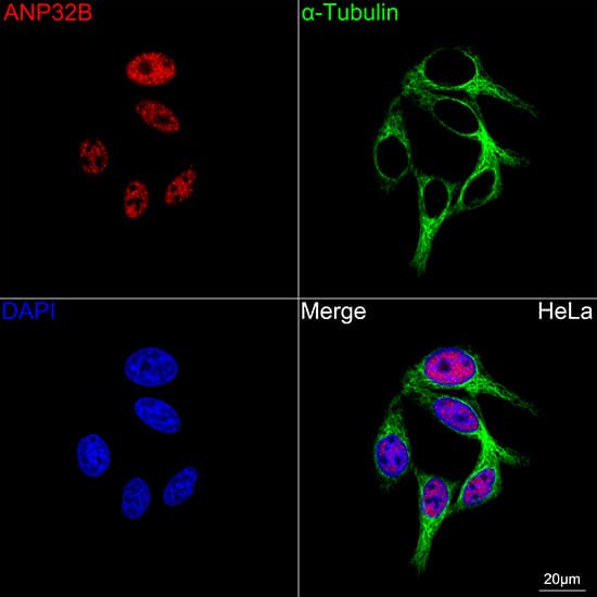 Immunocytochemistry/ Immunofluorescence: ANP32B Antibody (4A8E5) [NBP3-16199] - Confocal imaging of HeLa cells using ANP32B Rabbit mAb  followed by a further incubation with Cy3 Goat Anti-Rabbit IgG (H+L)  . The cells were counterstained with alpha-Tubulin Mouse mAb  followed by incubation with ABflo 488-conjugated Goat Anti-Mouse IgG (H+L) Ab  (Green). DAPI was used for nuclear staining (Blue). Objective: 100x.