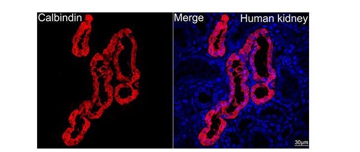 Human kidney tissue using Calbindin Rabbit mAb (dilution 1:100) followed by a further incubation with Cy3 Goat Anti-Rabbit IgG (H+L) (dilution 1:500) (Red). DAPI was used for nuclear staining (Blue). High pressure antigen retrieval performed with 0.01M Citrate Buffer (pH 6.0) prior to IF staining. Objective: 40x.