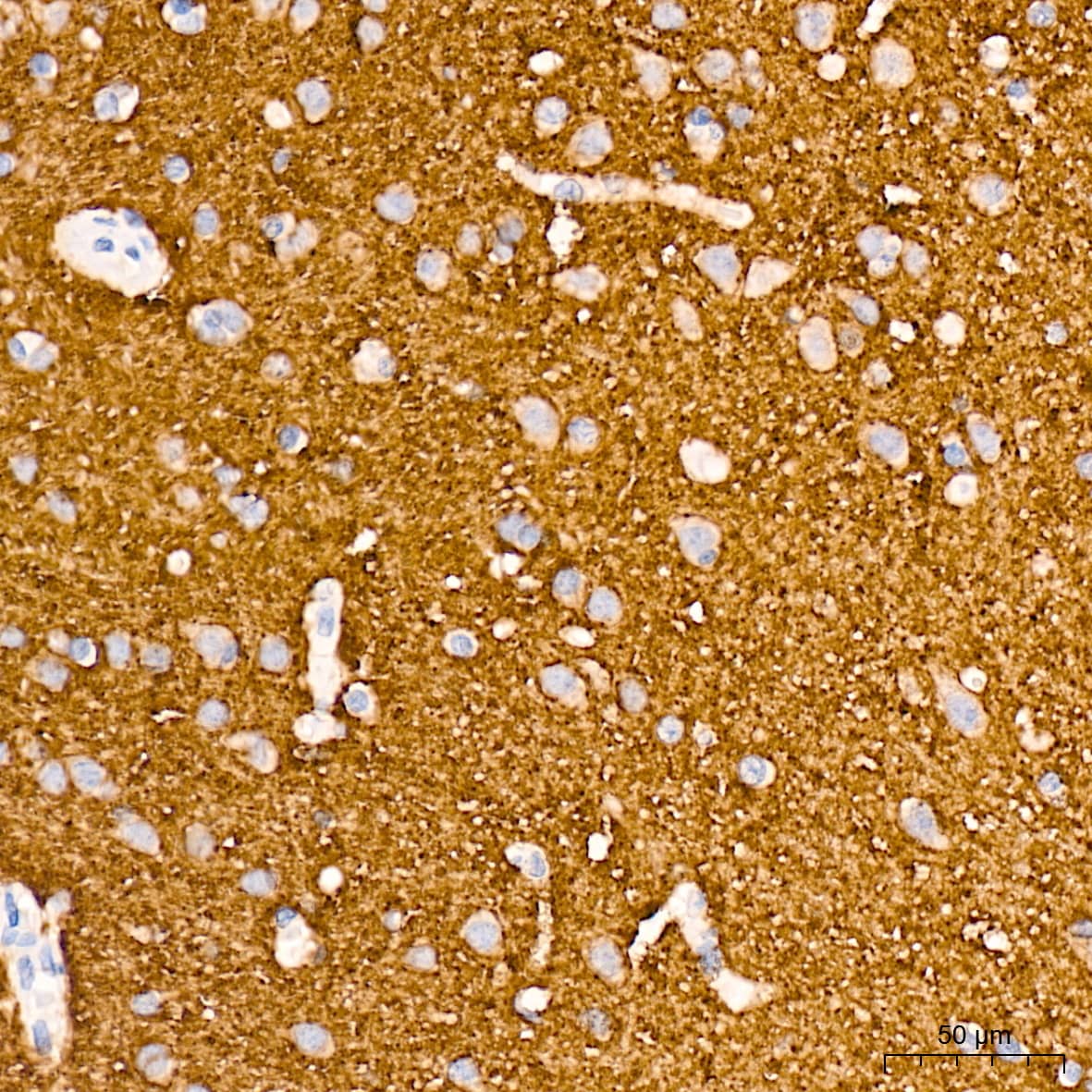 Immunohistochemistry: VAMP-1 Antibody (1A3K6) [NBP3-16212] - Immunohistochemistry analysis of VAMP-1 in paraffin-embedded human brain tissue using VAMP-1 Rabbit mAb  at a dilution of 1:200 (40x lens). High pressure antigen retrieval was performed with 0.01 M citrate buffer (pH 6.0) prior to IHC staining.