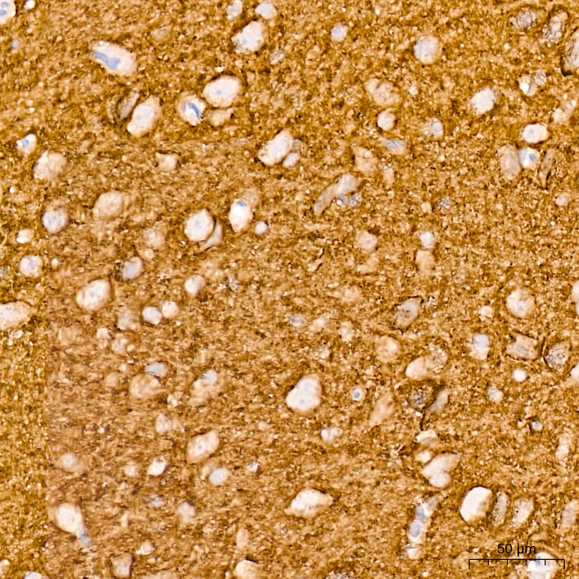 Immunohistochemistry: VAMP-1 Antibody (1A3K6) [NBP3-16212] - Immunohistochemistry analysis of VAMP-1 in paraffin-embedded rat brain tissue using VAMP-1 Rabbit mAb  at a dilution of 1:200 (40x lens). High pressure antigen retrieval was performed with 0.01 M citrate buffer (pH 6.0) prior to IHC staining.