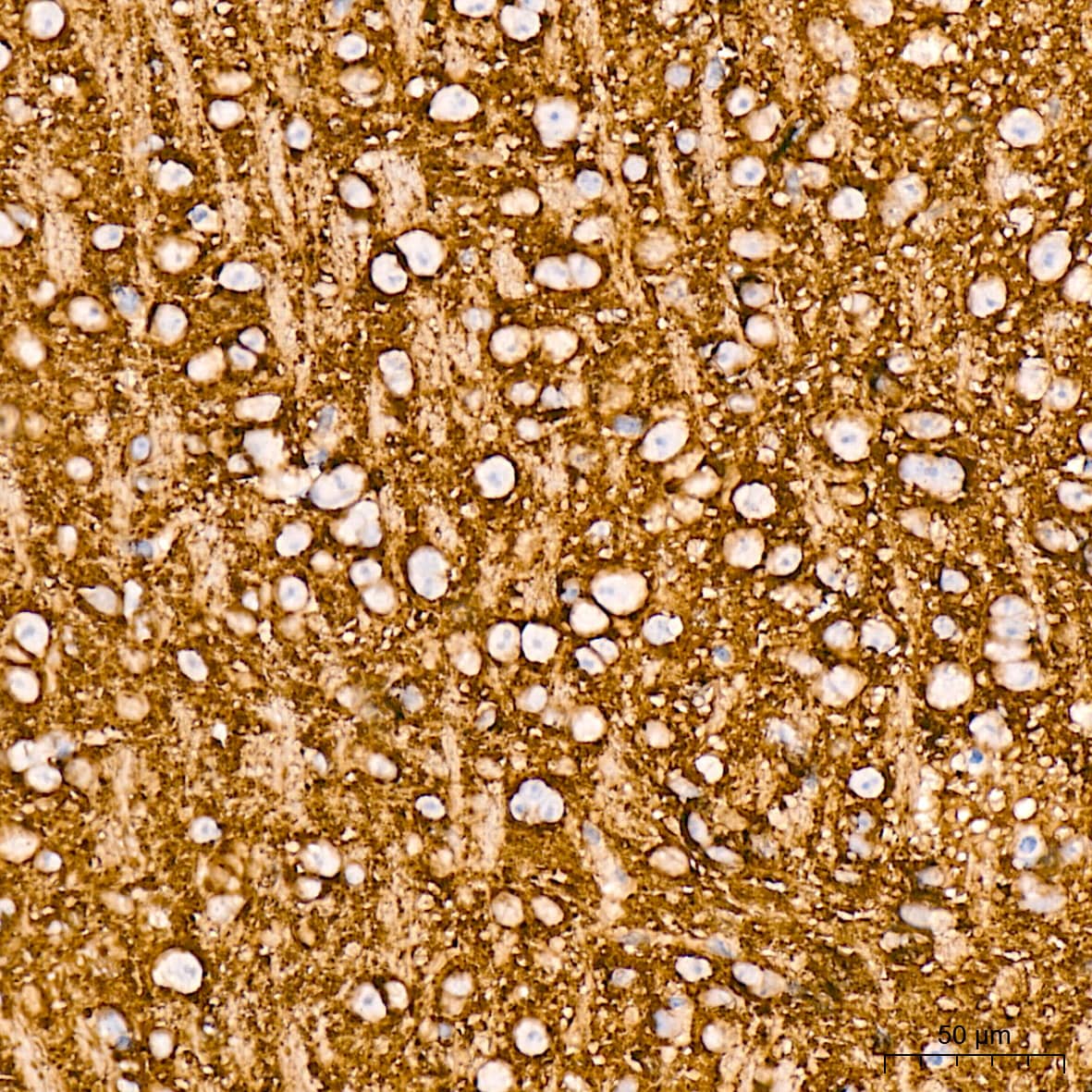 Immunohistochemistry: VAMP-1 Antibody (1A3K6) [NBP3-16212] - Immunohistochemistry analysis of VAMP-1 in paraffin-embedded mouse brain tissue using VAMP-1 Rabbit mAb  at a dilution of 1:200 (40x lens). High pressure antigen retrieval was performed with 0.01 M citrate buffer (pH 6.0) prior to IHC staining.