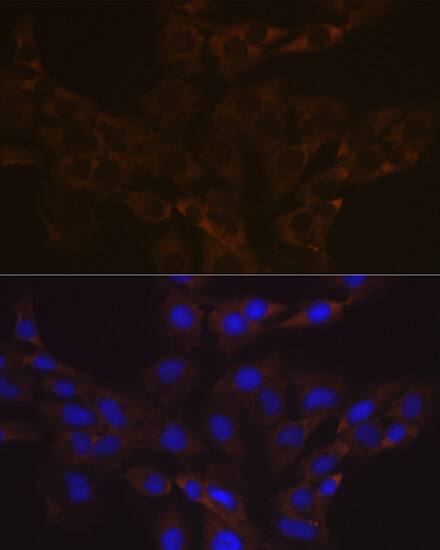 Immunocytochemistry/ Immunofluorescence: VAMP-1 Antibody (1A3K6) [NBP3-16212] - Immunofluorescence analysis of C6 cells using VAMP-1 Rabbit mAb  at dilution of 1:100 (40x lens). Secondary antibody: Cy3 Goat Anti-Rabbit IgG (H+L)  at 1:500 dilution. Blue: DAPI for nuclear staining.