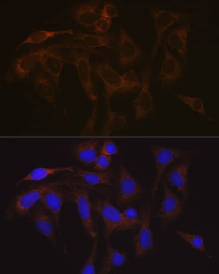 Immunocytochemistry/ Immunofluorescence: VAMP-1 Antibody (1A3K6) [NBP3-16212] - Immunofluorescence analysis of U-2 OS cells using VAMP-1 Rabbit mAb  at dilution of 1:100 (40x lens). Secondary antibody: Cy3 Goat Anti-Rabbit IgG (H+L)  at 1:500 dilution. Blue: DAPI for nuclear staining.