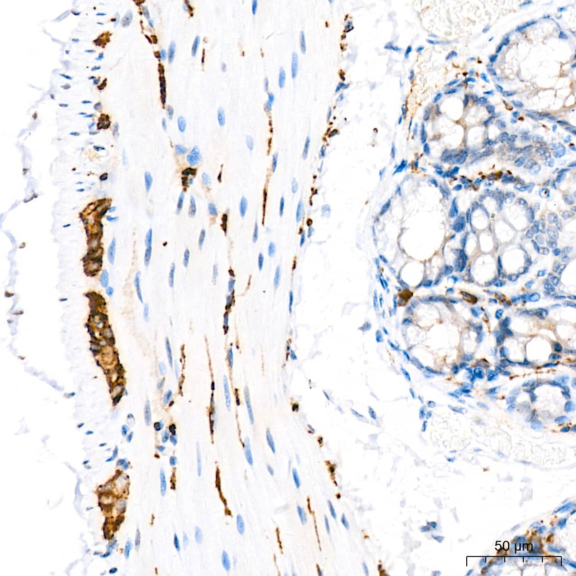 Immunohistochemistry: VAMP-1 Antibody (1A3K6) [NBP3-16212] - Immunohistochemistry analysis of VAMP-1 in paraffin-embedded mouse colon tissue using VAMP-1 Rabbit mAb  at a dilution of 1:200 (40x lens). High pressure antigen retrieval was performed with 0.01 M citrate buffer (pH 6.0) prior to IHC staining.