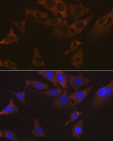 Immunocytochemistry/ Immunofluorescence: VAMP-1 Antibody (1A3K6) [NBP3-16212] - Immunofluorescence analysis of NIH-3T3 cells using VAMP-1 Rabbit mAb  at dilution of 1:100 (40x lens). Secondary antibody: Cy3 Goat Anti-Rabbit IgG (H+L)  at 1:500 dilution. Blue: DAPI for nuclear staining.