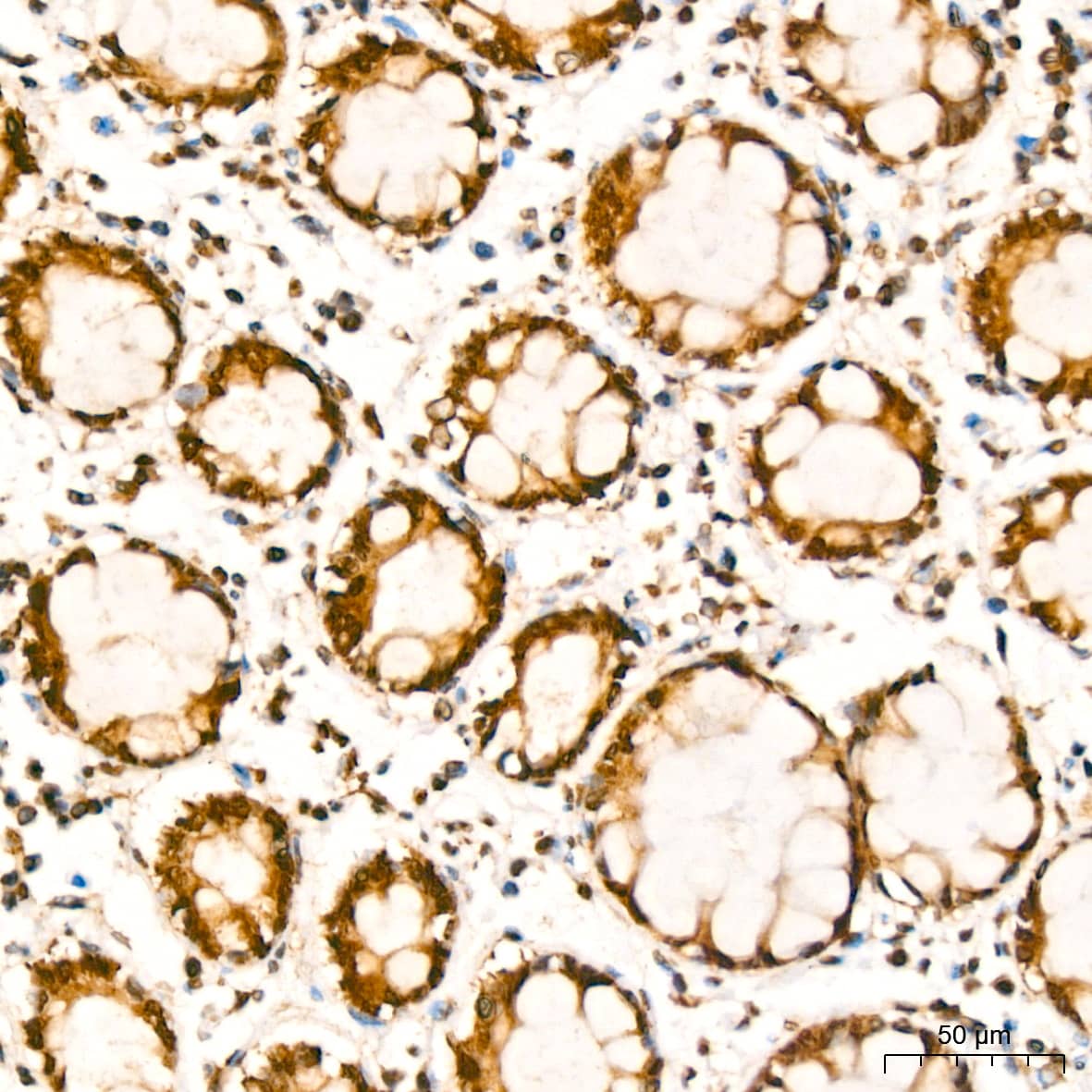 Immunohistochemistry: YB1 Antibody (9J7M4) [NBP3-16213] - Immunohistochemistry analysis of paraffin-embedded Human colon using YB1 Rabbit mAb at dilution of 1:200 (40x lens). High pressure antigen retrieval performed with 0.01M Citrate Bufferr (pH 6.0) prior to IHC staining.