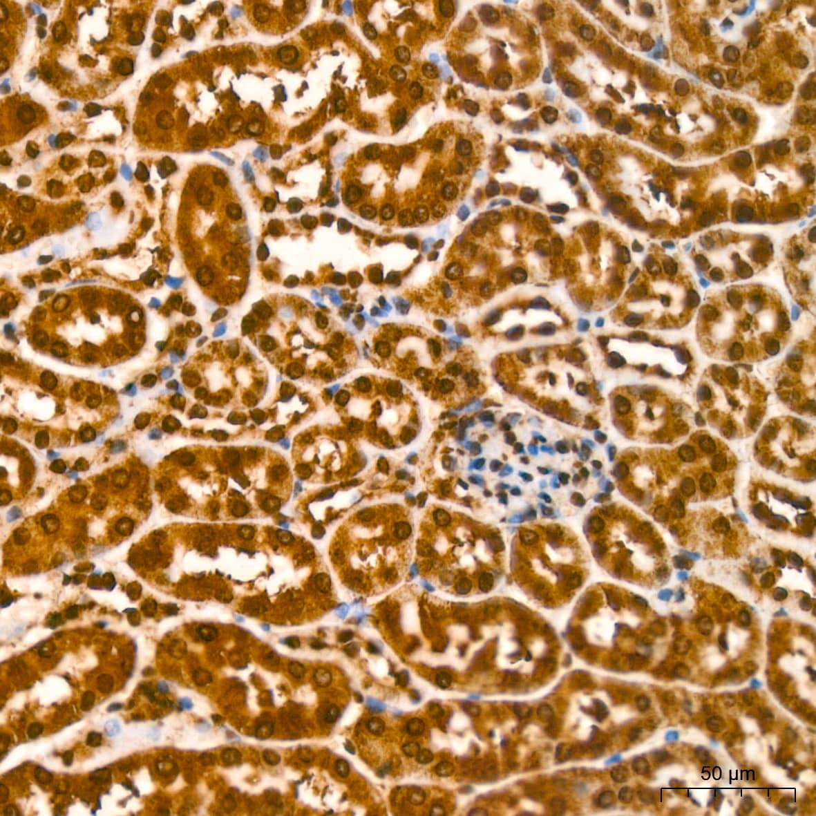 Immunohistochemistry: YB1 Antibody (9J7M4) [NBP3-16213] - Immunohistochemistry analysis of paraffin-embedded Mouse kidney using YB1 Rabbit mAb at dilution of 1:200 (40x lens). High pressure antigen retrieval performed with 0.01M Citrate Bufferr (pH 6.0) prior to IHC staining.