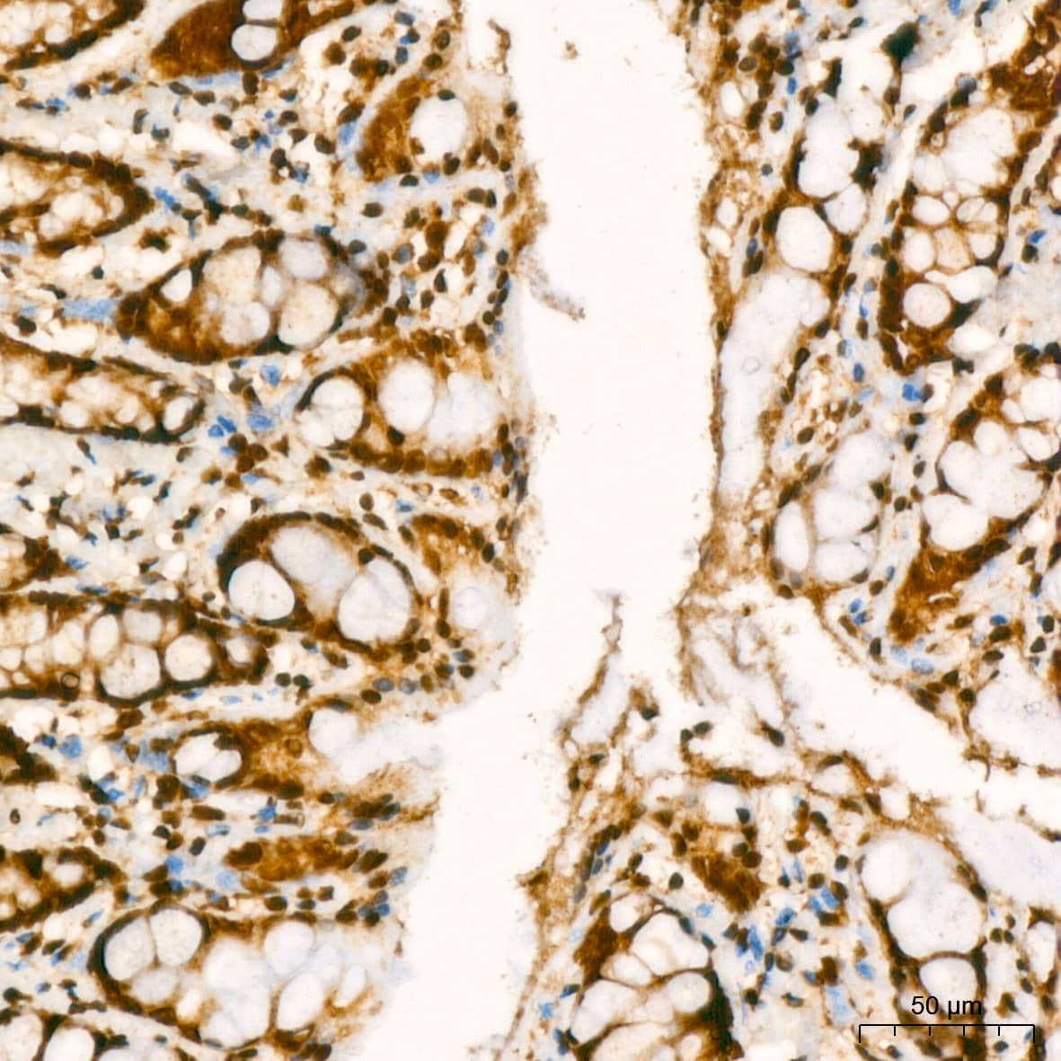 Immunohistochemistry: YB1 Antibody (9J7M4) [NBP3-16213] - Immunohistochemistry analysis of paraffin-embedded Rat colon using YB1 Rabbit mAb at dilution of 1:200 (40x lens). High pressure antigen retrieval performed with 0.01M Citrate Bufferr (pH 6.0) prior to IHC staining.