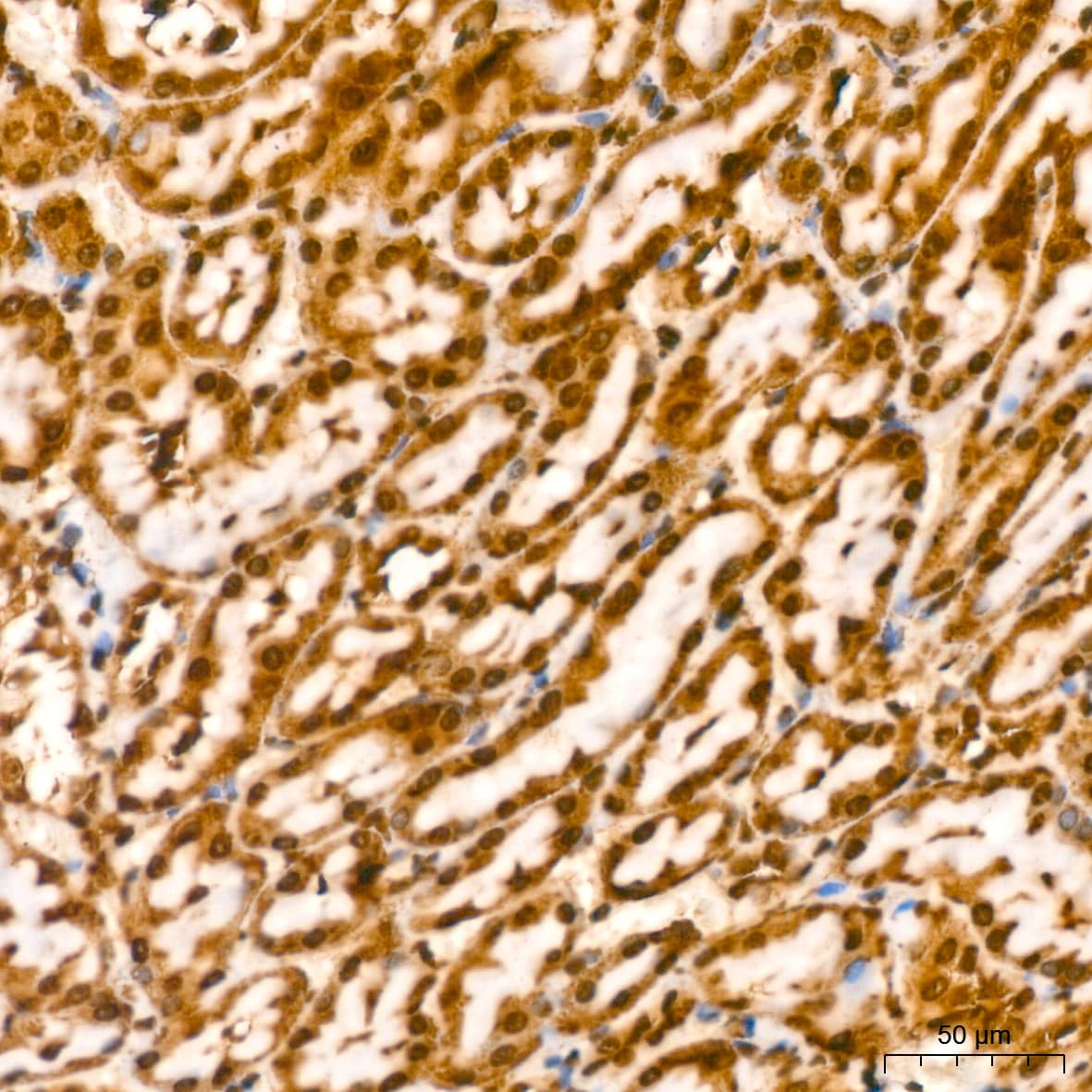 Immunohistochemistry: YB1 Antibody (9J7M4) [NBP3-16213] - Immunohistochemistry analysis of paraffin-embedded Rat kidney using YB1 Rabbit mAb at dilution of 1:200 (40x lens). High pressure antigen retrieval performed with 0.01M Citrate Bufferr (pH 6.0) prior to IHC staining.