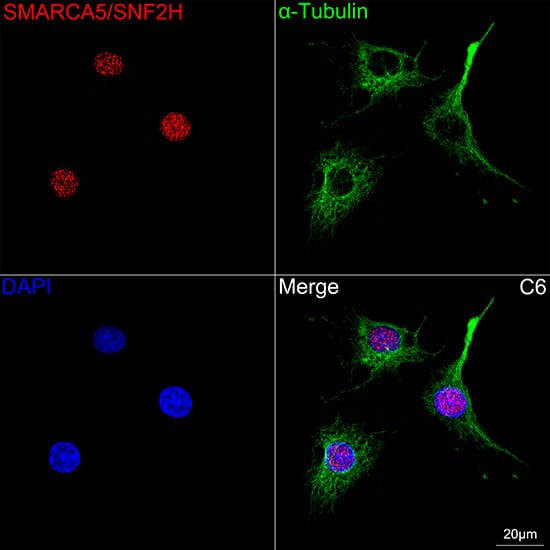 Immunocytochemistry/ Immunofluorescence: SMARCA5/SNF2H Antibody (6H8I7) [NBP3-16216] - Confocal imaging of C6 cells using SMARCA5/SNF2H Rabbit mAb followed by a further incubation with Cy3 Goat Anti-Rabbit IgG (H+L) . The cells were counterstained with alpha-Tubulin Mouse mAb followed by incubation with ABflo(R) 488-conjugated Goat Anti-Mouse IgG (H+L) Ab (Green). DAPI was used for nuclear staining (Blue). Objective: 100x.