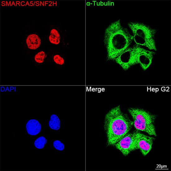 Immunocytochemistry/ Immunofluorescence: SMARCA5/SNF2H Antibody (6H8I7) [NBP3-16216] - Confocal imaging of Hep G2 cells using SMARCA5/SNF2H Rabbit mAb followed by a further incubation with Cy3 Goat Anti-Rabbit IgG (H+L) . The cells were counterstained with alpha-Tubulin Mouse mAb followed by incubation with ABflo(R) 488-conjugated Goat Anti-Mouse IgG (H+L) Ab (Green). DAPI was used for nuclear staining (Blue). Objective: 100x.