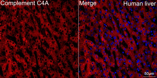 Immunocytochemistry/ Immunofluorescence: Complement C4a Antibody (4C3F2) [NBP3-16217] - Confocal imaging of paraffin-embedded Human liver tissue using Complement C4a Rabbit mAb  followed by a further incubation with Cy3 Goat Anti-Rabbit IgG (H+L)  . DAPI was used for nuclear staining (Blue). Objective: 40x. Perform high pressure antigen retrieval with 0.01 M citrate buffer (pH 6.0) prior to IF staining.