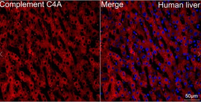 Immunohistochemistry: Complement C4a Antibody (4C3F2) [NBP3-16217] -Complement C4a Antibody (4C3F2) [NBP3-16217] -Human liver tissue using Complement C4A Rabbit mAb (dilution 1:100) followed by a further incubation with Cy3 Goat Anti-Rabbit IgG (H+L) (dilution 1:500) (Red). DAPI was used for nuclear staining (Blue). Objective: 40x. Perform high pressure antigen retrieval with 0.01 M citrate buffer (pH 6.0) prior to IF staining.