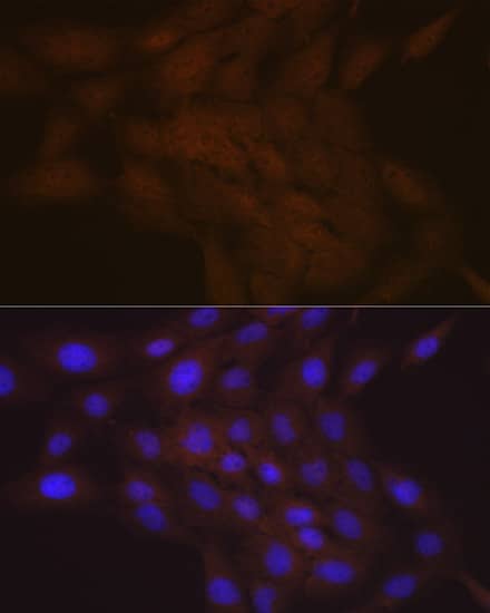 Immunocytochemistry/ Immunofluorescence: SMC4 Antibody (9Z8S3) [NBP3-16219] - Immunofluorescence analysis of C6 cells using SMC4 Rabbit mAb  at dilution of 1:100 (40x lens). Blue: DAPI for nuclear staining.
